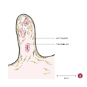 Free Illustration Dermal Papilla