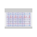 Svg Ecg Tracing