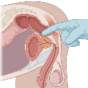 Digital Rectal Prostate Exam