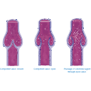 Venous Valves Anatomy 1