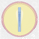 Antimicrobial Susceptibility Test By Etest