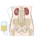 Nephrostomy
