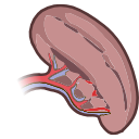 Free Illustration Human Spleen