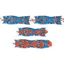 Deep Vein Thrombosis Dvt 1