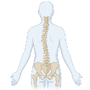 Scoliosis