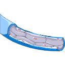 Single Capillary Structure 3