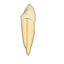 Maxillary Canine