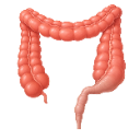 Hirschsprung Disease