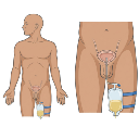 Foley Catheter Bag