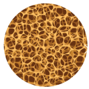 Bone Cross Section Osteoporosis