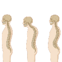 Normal Kyphosis Lordosis Sequence