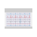 Svg Ecg Tracing